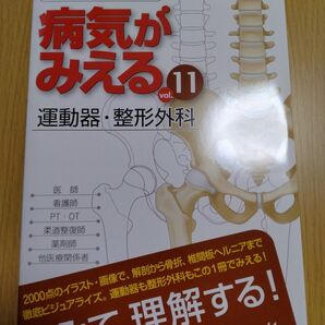 病気がみえる　ｖｏｌ．１１ 医療情報科学研究所／編集