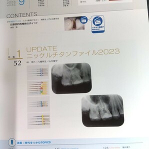 クインテッセンス 2023年9月号 UPDATEニッケルチタンファイル2023の画像2