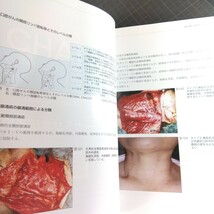 Jop矯正臨床ジャーナル　2023年7月号　歯科医療と粘膜疾患:口腔がんを中心に-10　口腔がんの治療（4）_画像4