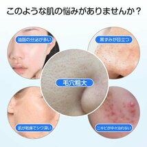 毛穴吸引器 保湿 毛穴ケア 美顔器 吸引 毛穴クリーン 角栓除去 黒ずみ 毛穴汚れ イチゴ鼻吸引 美肌 フェイスケア 2023 プレゼントHTY-X4-WH_画像2