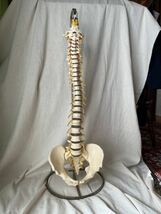 SOMSO製　人体模型 脊柱骨盤股関節 脊柱模型骨盤 カイロプラクティック 整骨院 骨格模型 ドイツ製　スタンド付_画像1