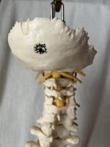SOMSO製　人体模型 脊柱骨盤股関節 脊柱模型骨盤 カイロプラクティック 整骨院 骨格模型 ドイツ製　スタンド付_画像5