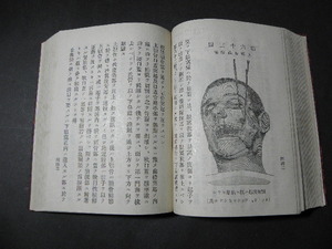 79 大正刊 軍陣外科新編 / 戦前 軍隊 軍医 日本軍 軍医 医学 医療 手術 戦争 古書