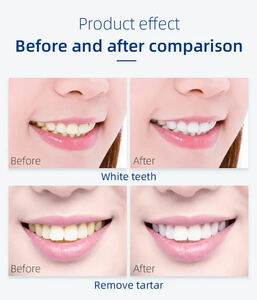  tooth. whitening ( gel 10ps.@)