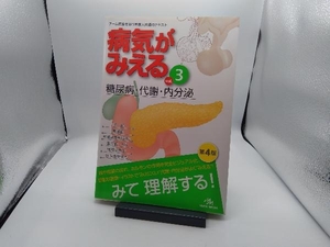 病気がみえる 糖尿病・代謝・内分泌 第4版(vol.3) 医療情報科学研究所