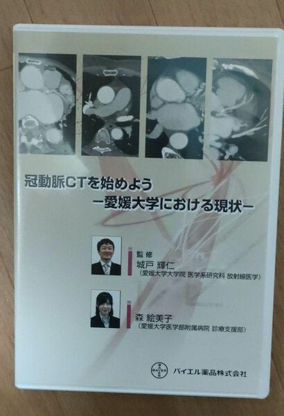 冠動脈CTを始めよう 愛媛大学における現状