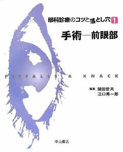 眼科診療のコツと落とし穴(１) 前眼部-手術／樋田哲夫，江口秀一郎【編】