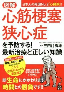 図解　心筋梗塞・狭心症を予防する！最新治療と正しい知識 日本人の死因Ｎｏ．２「心臓病」！／三田村秀雄