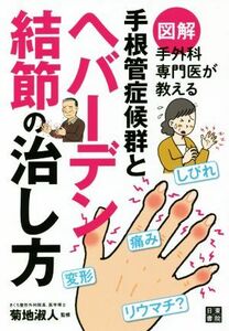 図解　手外科専門医が教える手根管症候群とヘバーデン結節の治し方／菊地淑人