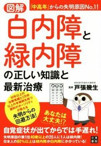 図解　白内障と緑内障の正しい知識と最新治療／戸張幾生