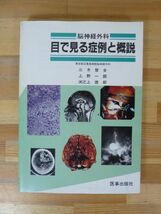 T38▽脳神経外科 目で見る症例と概説 医事出版社 三木啓全 上野一朗 渕之上徳郎 脳腫瘍 外傷 CT 硬膜下血腫 頭蓋骨骨折 モヤモヤ病 231219_画像1