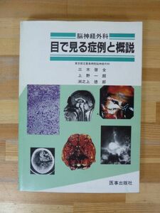 T38▽脳神経外科 目で見る症例と概説 医事出版社 三木啓全 上野一朗 渕之上徳郎 脳腫瘍 外傷 CT 硬膜下血腫 頭蓋骨骨折 モヤモヤ病 231219