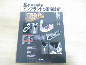 ●01)【同梱不可】基本から学ぶインプラントの画像診断/金田隆/森進太郎/砂書房/2008年発行