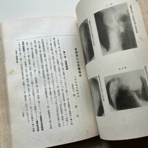 【戦前】結核及其治療法　伊東祐彦編纂　1922年　博文社　10いyn_画像7