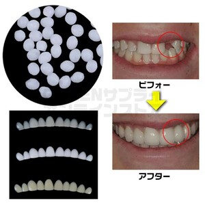 ダミートゥース 3色 差し歯 仮歯 テンポラリートゥース フィッティングビーズ