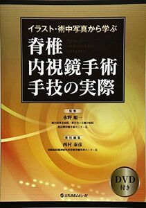 [A12220732]イラスト・術中写真から学ぶ脊椎内視鏡手術手技の実際―DVD付き [大型本] 西村 泰彦