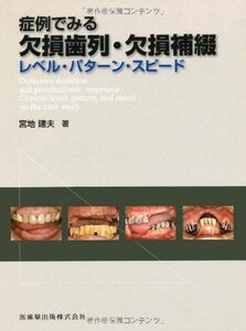 [A11327662]症例でみる欠損歯列・欠損補綴レベル・パターン・スピード [単行本（ソフトカバー）] 宮地 建夫