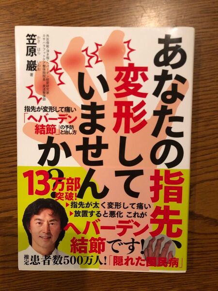 あなたの指先、変形していませんか?