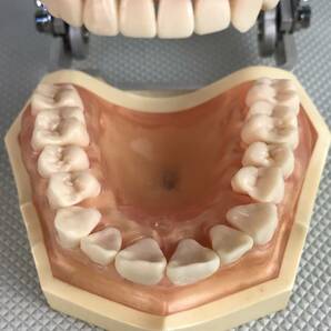 A9826●NISSIN ニッシン DENTAL MODEL デンタルモデル 162H-2 ゼツZ-1 歯科模型 歯科材料 歯医者 模型 歯 中古の画像8