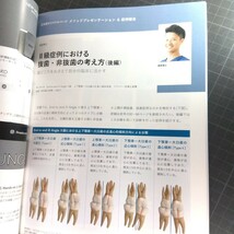 JAO　Journal of Aligner Orthodontics日本版 '24-1増大号　Ⅱ級症例における抜歯・非抜歯の考え方_画像8