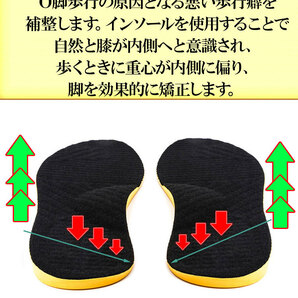 インソール O脚矯正 中敷き 土踏まずインソール 扁平足 アーチサポーター 美脚 足底筋膜 O脚X脚対策 ひざ 腰を緩和 O脚対策グッズの画像2