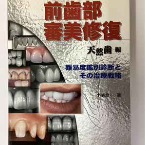 小濵忠一先生の「全歯部審美修復」天然歯編