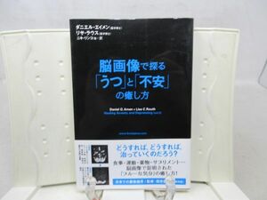 G2■脳画像で探る「うつ」と「不安」の癒し方【著】ダニエル・エイメン【発行】花風社 2004年 ◆並■