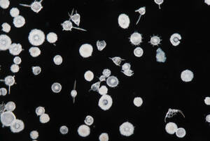 バルバドス (Barbados) 島産 放散虫 (Radiolaria) プレパラート 顕微鏡標本 微化石 微生物 プランクトン 大003+おまけ