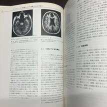 CT診断のための脳解剖と機能系 1986.10 訳・久留裕 真柳　初版【A21】_画像7