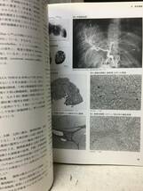 即決　病院払下げ本　臨床肝癌〈2〉症状・診断 (現代医科学大系)遠藤 康夫 　医学書・大型本_画像5