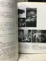 即決　病院払下げ本　臨床肝癌〈2〉症状・診断 (現代医科学大系)遠藤 康夫 　医学書・大型本_画像7