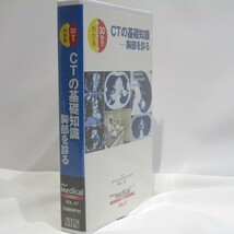 Nikkei　メディカルビデオ　VOL.47　30分でわかる　CTの基礎知識-胸部を見る_画像2