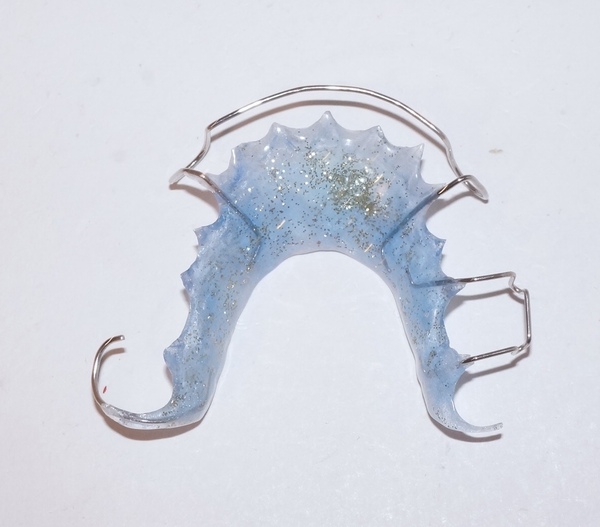 リテーナー 歯科 模型 矯正 審美 保定装置 サンプル 資料 説明 小児歯科