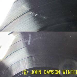 JOHNNY WINTER ジョニー・ウィンター 輸入盤LP  8点セットの画像8