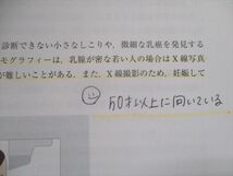 TL93-075 京都廣川書店 分子病態薬理学III-がん化学療法とがん性疼痛治療 - 2017 sale 22S1D_画像4