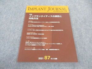 WF04-085 ゼニス出版 インプラントジャーナル 2021年 87号 状態良い 08S3D