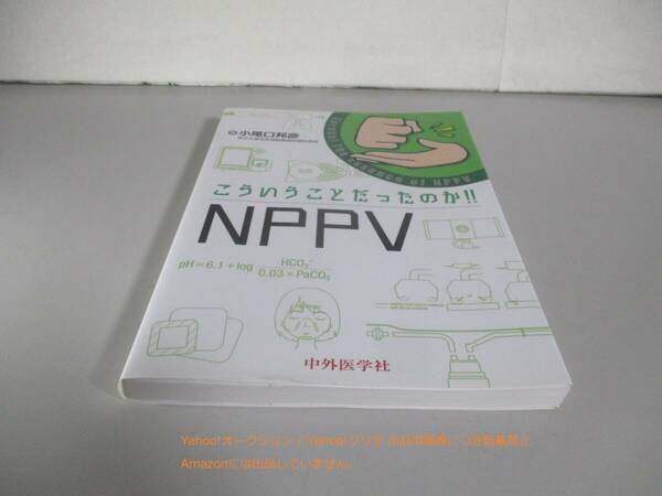 こういうことだったのか!! NPPV