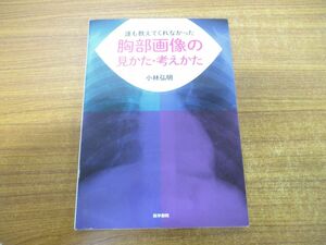 ●01)【同梱不可】誰も教えてくれなかった胸部画像の見かた・考えかた/小林弘明/医学書院/2019年発行/A