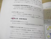 ●01)【同梱不可】神経病理インデックス/新井信隆/医学書院/2005年発行/A_画像4