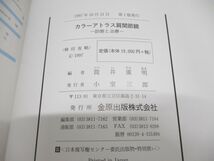 ●01)【同梱不可】カラーアトラス肩関節鏡/診断と治療/筒井広明/金原出版/1997年/A_画像4