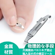 巻き爪ケアクリップ ワイヤー ガード 爪ブロック テープ 巻きづめ 治し方　矯正　テープ 巻きづめ 靴 巻爪 対策 足の巻き爪 防止_画像1