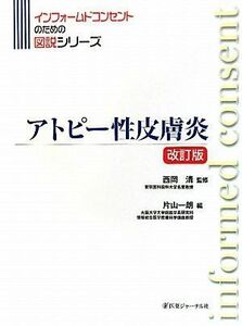 [A12194720]アトピー性皮膚炎 (インフォームドコンセントのための図説シリーズ) [大型本] 清，西岡; 一朗，片山