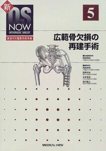 [A01458921]広範骨欠損の再建手術 (新OS NOW―新世代の整形外科手術) 宗昭，阿部、 幸英，岩本、 邦夫，高岡; 直之，落合