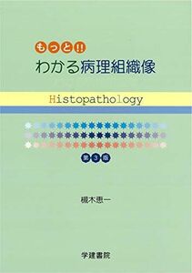 [A11260793]わかる病理組織像―歯科国試完全攻略 [単行本] 槻木 恵一