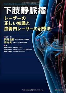 [A11446793]下肢静脈瘤 レーザーの正しい知識と血管内レーザーの治療法 [単行本] 岡田 昌義、 菊地 眞、 橋新 裕一、 多田 誠一; 榊原