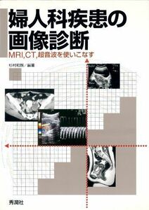 [A01297800]婦人科疾患の画像診断―MRI・CT・超音波を使いこなす 杉村 和朗