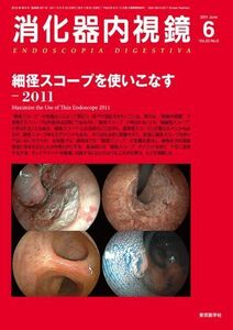 [A01259629]消化器内視鏡第23巻6号　細径スコープを使いこなす―2011 (消化器内視鏡2011年6月号) 消化器内視鏡編集委員会