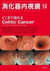 [A12194860]消化器内視鏡第24巻12号 どこまで迫れるColitic Cancer (消化器内視鏡2012年12月号) 消化器内視鏡編集委員