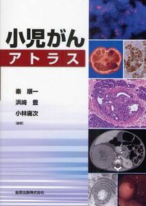 [A01972342]小児がんアトラス [単行本] 秦 順一、 浜崎 豊; 小林 庸次