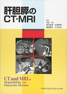 [A01632557]肝胆膵のCT・MRI [単行本] 本田浩、 角谷眞澄、 吉満研吾、 蒲田敏文; 入江裕之